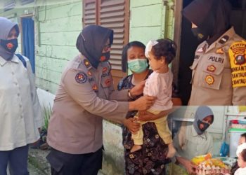 Wujud Peduli Terhadap Sesama, Polwan Kunjungi Anak Penderita Hidrosefalus